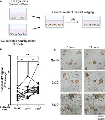 Antibody-dependent cellular cytotoxicity-inducing antibodies enhance the natural killer cell anti-cancer response against patient-derived pancreatic cancer organoids